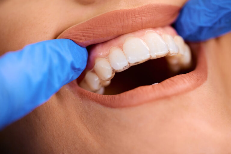 tirzepatide tooth pain Ozempic and Oral Health: What You Need to Know
